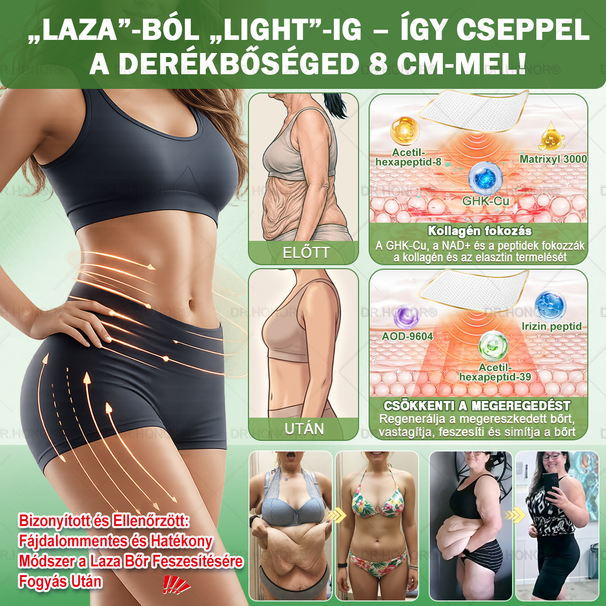 [𝟐𝟎𝟐𝟔 Ú𝐉 & 𝐭𝐨𝐯á𝐛𝐛𝐟𝐞𝐣𝐥𝐞𝐬𝐳𝐭𝐞𝐭𝐭: 𝟖𝟎% 𝐊𝐄𝐃𝐕𝐄𝐙𝐌É𝐍𝐘] 𝐃𝐑.𝐇𝐎𝐍𝐎𝐑® 𝐧𝐲𝐢𝐫𝐨𝐤𝐝𝐫𝐞𝐧á𝐳𝐬 𝐟𝐨𝐠𝐲𝐚𝐬𝐳𝐭ó 𝐧𝐚𝐧𝐨-𝐦𝐢𝐤𝐫𝐨𝐭ű𝐬 𝐭𝐚𝐩𝐚𝐬𝐳: 𝐮𝐥𝐭𝐫𝐚-𝐞𝐫ő𝐬 𝟓× 𝐟𝐨𝐫𝐦𝐮𝐥𝐚 𝐥𝐢𝐩𝐨𝐥𝐢𝐭𝐢𝐤𝐮𝐬 𝐩𝐞𝐩𝐭𝐢𝐝𝐤𝐨𝐦𝐩𝐥𝐞𝐱𝐬𝐳𝐞𝐥 — 𝐭á𝐦𝐨𝐠𝐚𝐭𝐣𝐚 𝐚 𝐟𝐨𝐠𝐲á𝐬𝐭 é𝐬 𝐚 𝐧𝐲𝐢𝐫𝐨𝐤𝐤𝐞𝐫𝐢𝐧𝐠é𝐬𝐭 𝐚𝐳 í𝐳ü𝐥𝐞𝐭𝐢 𝐤𝐨𝐦𝐟𝐨𝐫𝐭𝐛𝐚𝐧, 𝐣𝐨𝐛𝐛 𝐚𝐥𝐯á𝐬𝐛𝐚𝐧, 𝐦𝐞𝐧𝐭á𝐥𝐢𝐬 𝐭𝐢𝐬𝐳𝐭𝐚𝐬á𝐠𝐨𝐭
