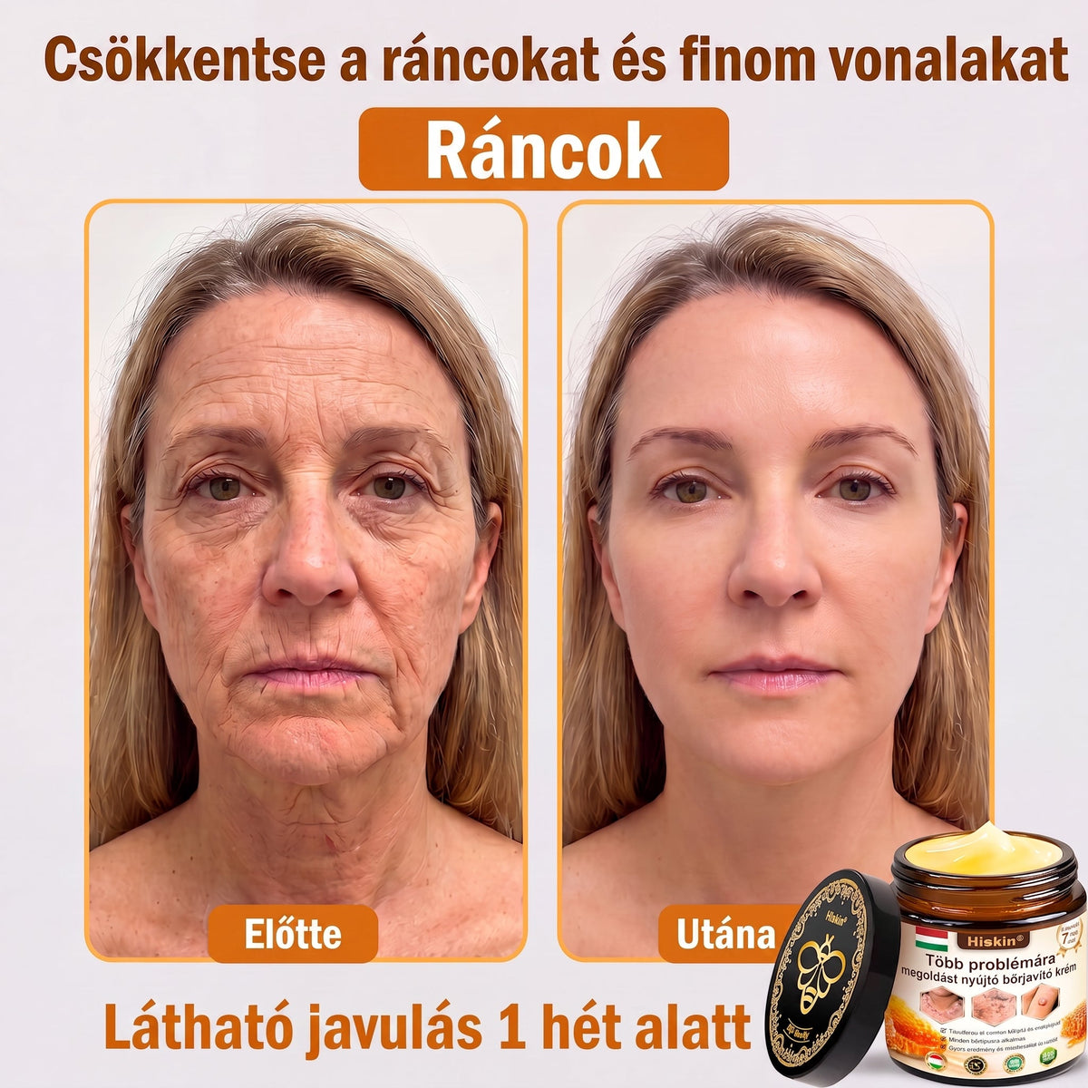 HISKIN® Multi-Concern Skin Repair Cream ✨ (One powerful cream to repair inflammation, dryness, aging, pigmentation, and visible skin damage.)
