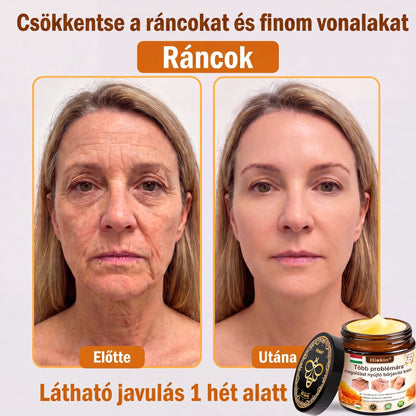 HISKIN® Multi-Concern Skin Repair Cream ✨ (One powerful cream to repair inflammation, dryness, aging, pigmentation, and visible skin damage.)