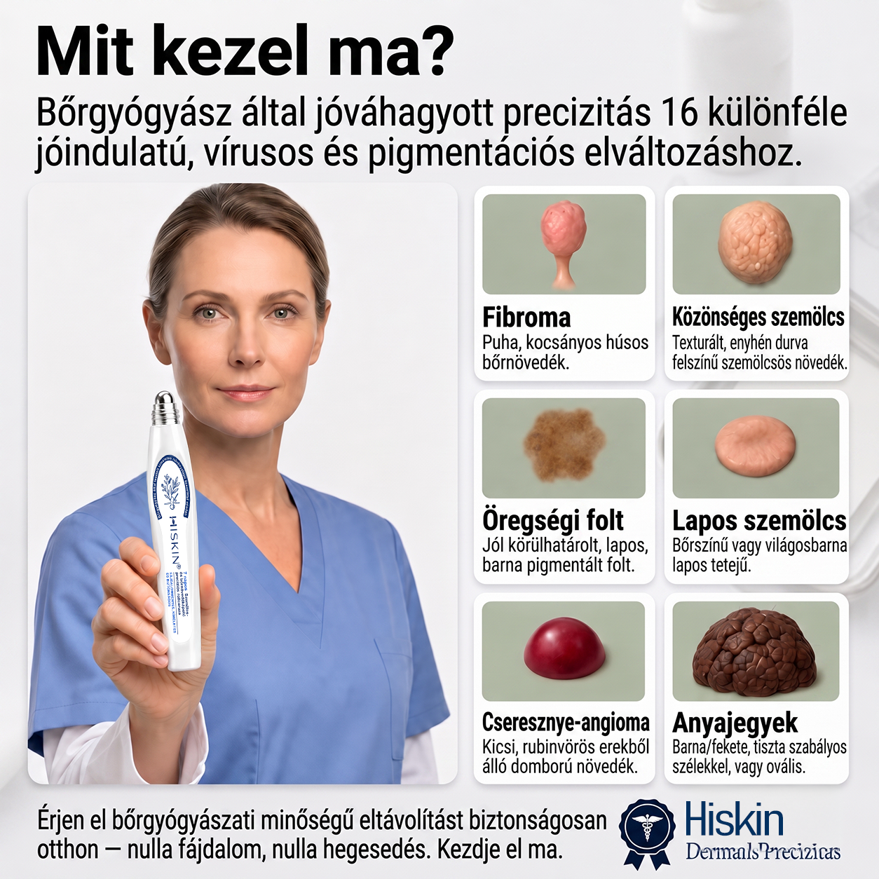 💕Hivatalos Márkabolt | 🚢🚢 Hiskin® 7 napos Szemölcseltávolító Roll-on Ápoló Folyadék (Fájdalommentes rollerball technológia, hegek nélkül) 🐬
