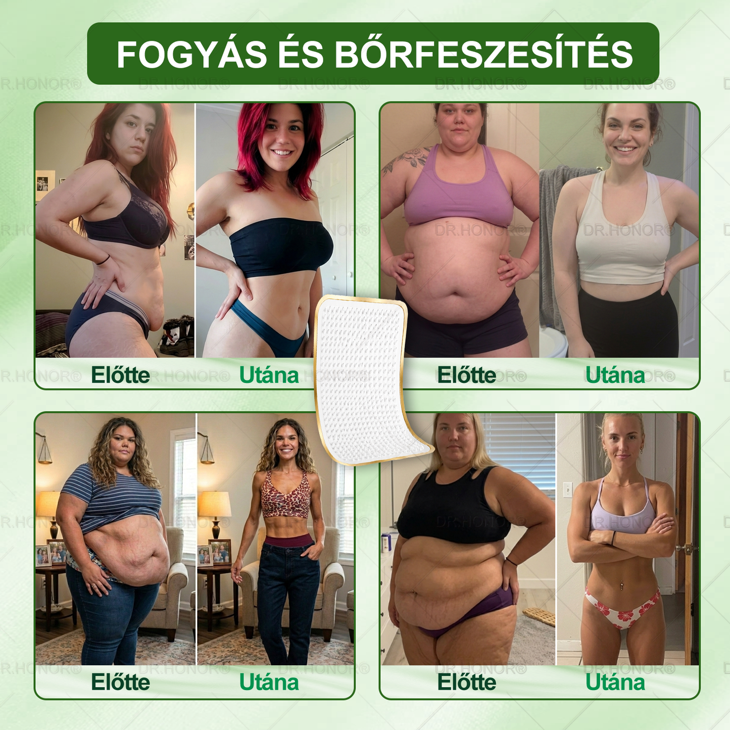 [𝟐𝟎𝟐𝟔 Ú𝐉 & 𝐭𝐨𝐯á𝐛𝐛𝐟𝐞𝐣𝐥𝐞𝐬𝐳𝐭𝐞𝐭𝐭: 𝟖𝟎% 𝐊𝐄𝐃𝐕𝐄𝐙𝐌É𝐍𝐘] 𝐃𝐑.𝐇𝐎𝐍𝐎𝐑® 𝐧𝐲𝐢𝐫𝐨𝐤𝐝𝐫𝐞𝐧á𝐳𝐬 𝐟𝐨𝐠𝐲𝐚𝐬𝐳𝐭ó 𝐧𝐚𝐧𝐨-𝐦𝐢𝐤𝐫𝐨𝐭ű𝐬 𝐭𝐚𝐩𝐚𝐬𝐳: 𝐮𝐥𝐭𝐫𝐚-𝐞𝐫ő𝐬 𝟓× 𝐟𝐨𝐫𝐦𝐮𝐥𝐚 𝐥𝐢𝐩𝐨𝐥𝐢𝐭𝐢𝐤𝐮𝐬 𝐩𝐞𝐩𝐭𝐢𝐝𝐤𝐨𝐦𝐩𝐥𝐞𝐱𝐬𝐳𝐞𝐥 — 𝐭á𝐦𝐨𝐠𝐚𝐭𝐣𝐚 𝐚 𝐟𝐨𝐠𝐲á𝐬𝐭 é𝐬 𝐚 𝐧𝐲𝐢𝐫𝐨𝐤𝐤𝐞𝐫𝐢𝐧𝐠é𝐬𝐭 𝐚𝐳 í𝐳ü𝐥𝐞𝐭𝐢 𝐤𝐨𝐦𝐟𝐨𝐫𝐭𝐛𝐚𝐧, 𝐣𝐨𝐛𝐛 𝐚𝐥𝐯á𝐬𝐛𝐚𝐧, 𝐦𝐞𝐧𝐭á𝐥𝐢𝐬 𝐭𝐢𝐬𝐳𝐭𝐚𝐬á𝐠𝐨𝐭