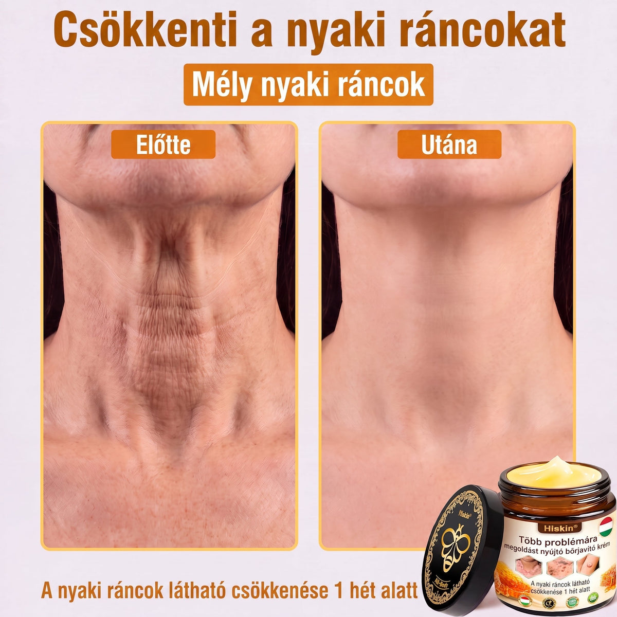 HISKIN® Multi-Concern Skin Repair Cream ✨ (One powerful cream to repair inflammation, dryness, aging, pigmentation, and visible skin damage.)