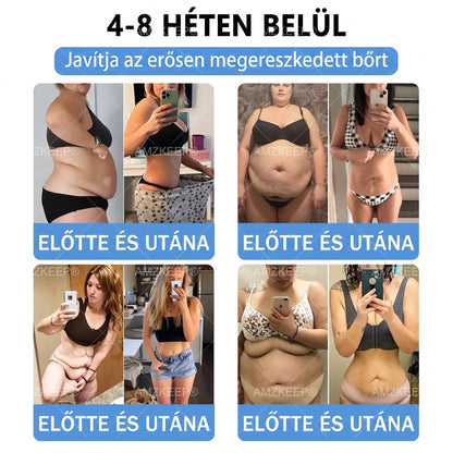 𝐀𝗠𝒁𝑲𝗘𝑬𝙋® 𝐀𝗠𝗣𝑲𝐌𝗼𝗿𝗶𝗻𝗴𝗮𝐁𝗲𝗿𝗯𝗲𝗿𝗶𝗻 𝟏𝟎-𝗮𝘇-𝟏 𝐌𝗲𝘁𝗮𝗯𝗼𝗹𝗶𝗸𝘂𝘀 𝐓á𝗺𝗼𝗴𝗮𝘁á𝘀 𝐍𝗮𝗻𝗼 𝐌𝗶𝗸𝗿𝗼𝘁ű𝘀 𝐓𝗮𝗽𝗮𝘀𝘇 🇭🇺 (𝗡𝗮𝗽𝗼𝗻𝘁𝗮 𝗲𝗴𝘆𝘀𝘇𝗲𝗿𝗶 𝗵𝗮𝘀𝘇𝗻á𝗹𝗮𝘁, 𝗹á𝘁𝘃á𝗻𝘆𝗼𝘀 𝘃á𝗹𝘁𝗼𝘇á𝘀 𝟳 𝗻𝗮𝗽 𝗮𝗹𝗮𝘁𝘁) ✅ 𝗧ú𝗹𝘀ú𝗹𝘆, 𝗹𝗮𝘇𝗮 𝗯ő𝗿, 𝘃é𝗿𝗰𝘂𝗸𝗼𝗿-𝗲𝗴𝘆𝗲𝗻𝘀ú𝗹𝘆, 𝗮𝗹𝘃á𝘀𝗶 𝗽𝗿𝗼𝗯𝗹é𝗺á𝗸, í𝘇ü𝗹𝗲𝘁𝗶 𝗽𝗮𝗻𝗮𝘀𝘇𝗼𝗸 é𝘀 𝗲𝗴𝘆é𝗯 𝘁𝗲𝗿ü𝗹𝗲𝘁𝗲𝗸 𝘁á𝗺𝗼𝗴𝗮𝘁á𝘀á𝗿𝗮