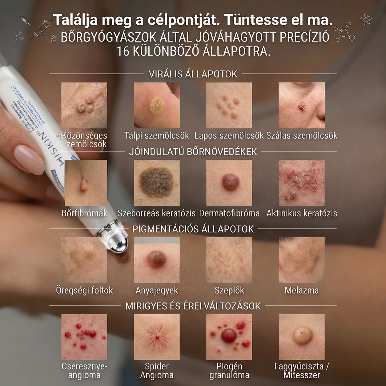 💕Hivatalos Márkabolt | 🚢🚢 Hiskin® 7 napos Szemölcseltávolító Roll-on Ápoló Folyadék (Fájdalommentes rollerball technológia, hegek nélkül) 🐬