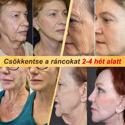 HISKIN® Multi-Concern Skin Repair Cream ✨ (One powerful cream to repair inflammation, dryness, aging, pigmentation, and visible skin damage.)